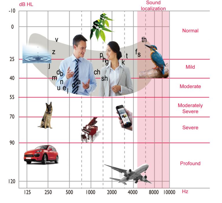  what Is Hearing Loss Care For Hearing Centre